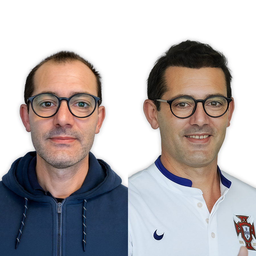 Before and after Choi Pen — 3,600 grafts, patient from Dubai